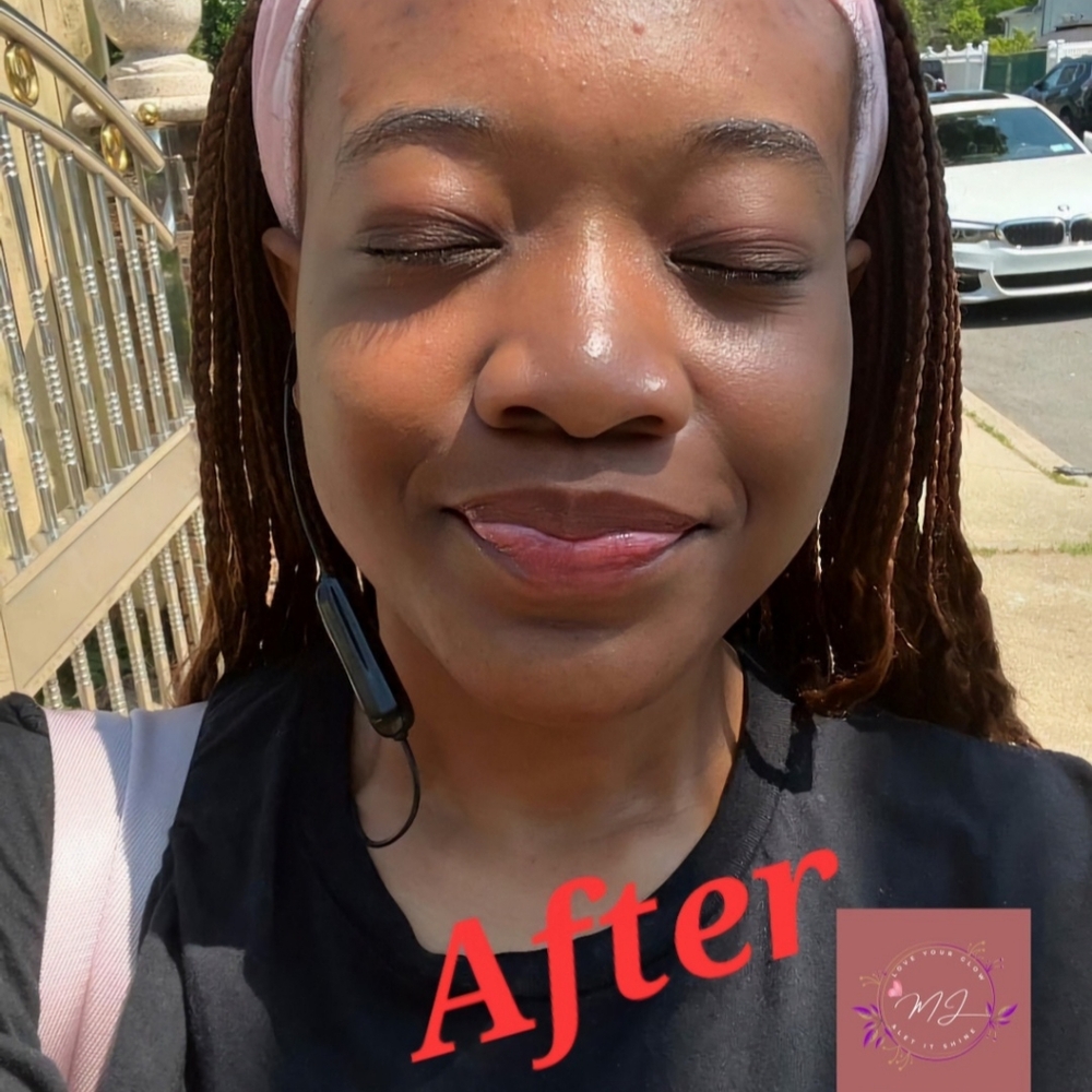Exfoliator - Picture 5 of 8